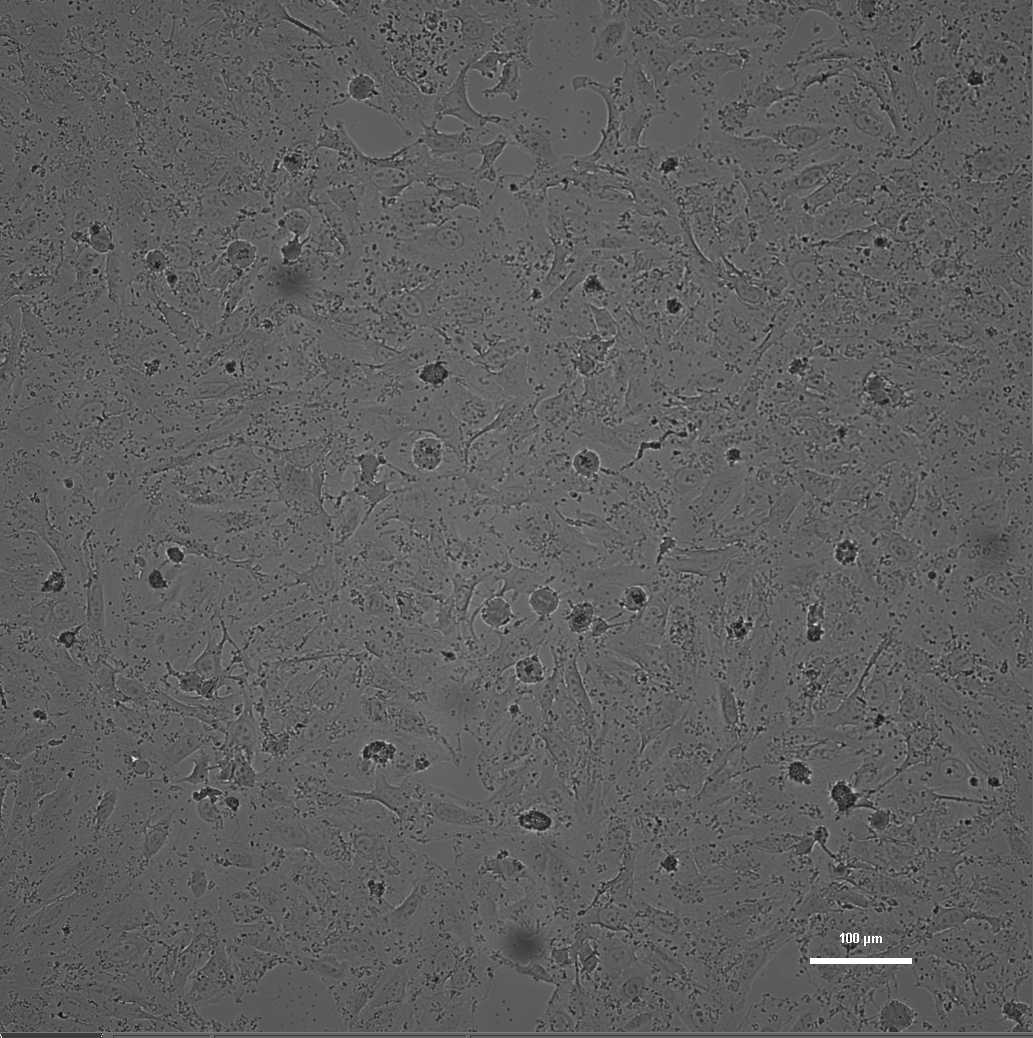 Cells in Brightfield.png